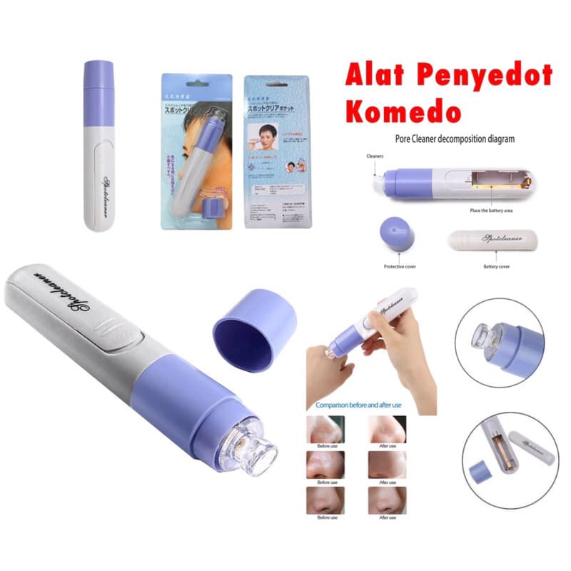 Alat Penyedot Komedo Vakum Pembersih Penghilang Komedo Perawatan Wajah